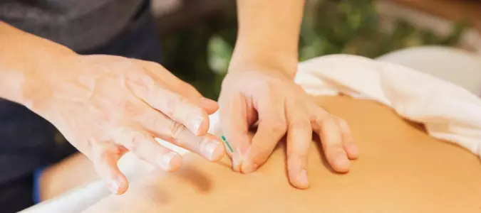 Acupuncture deemed effective for chronic lower back pain in seniors