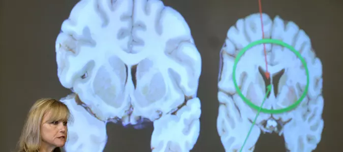 Here's what to know about CTE, the brain disease the NYC shooter blamed for his mental health issues