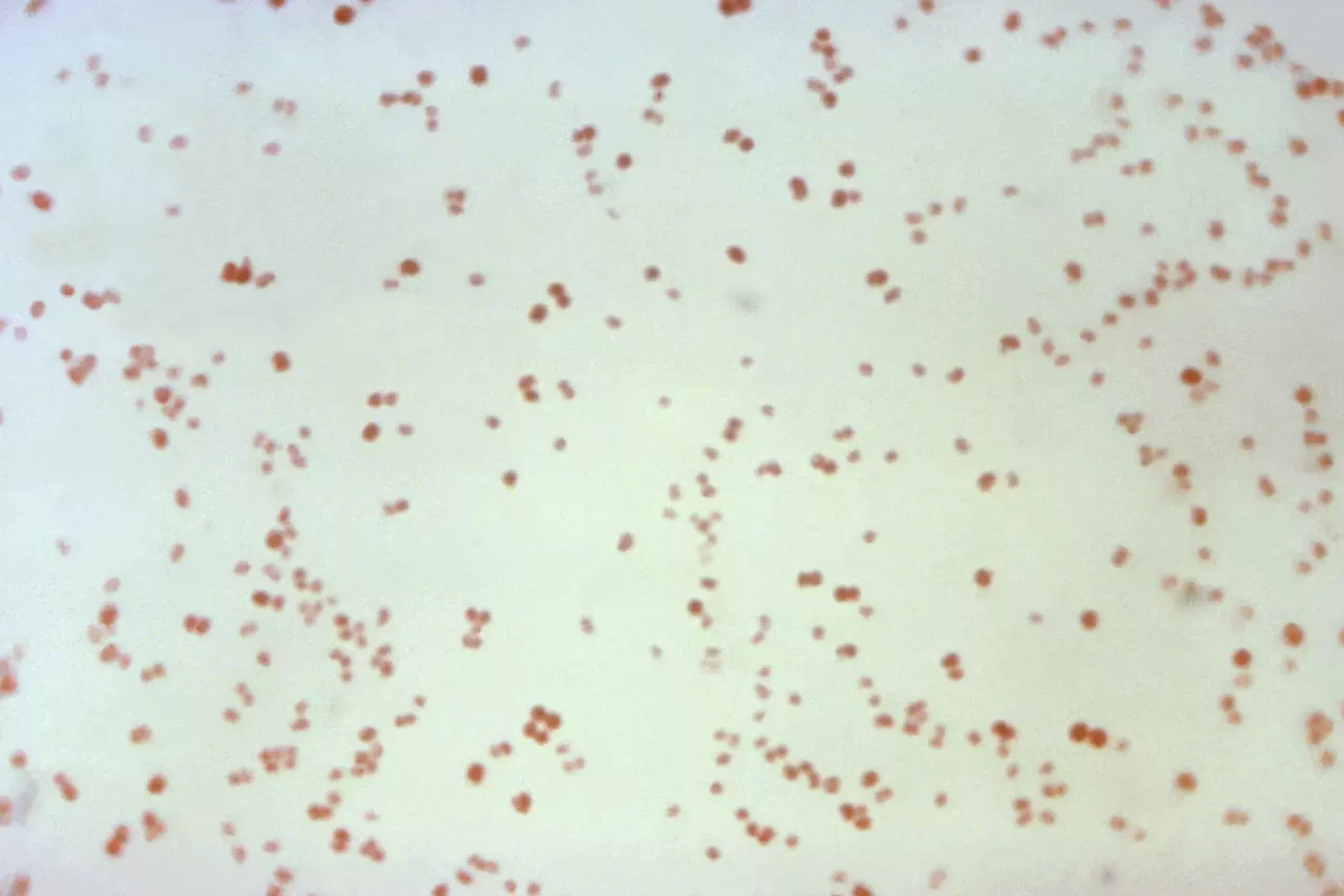 Sexually transmitted disease cases fall, but not syphilis in newborns