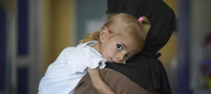 Toddler evacuated from Gaza with rare disease recovers from malnutrition in Italian hospital